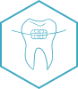 Braces