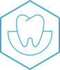 Root Canal