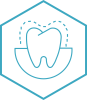 Veneers
